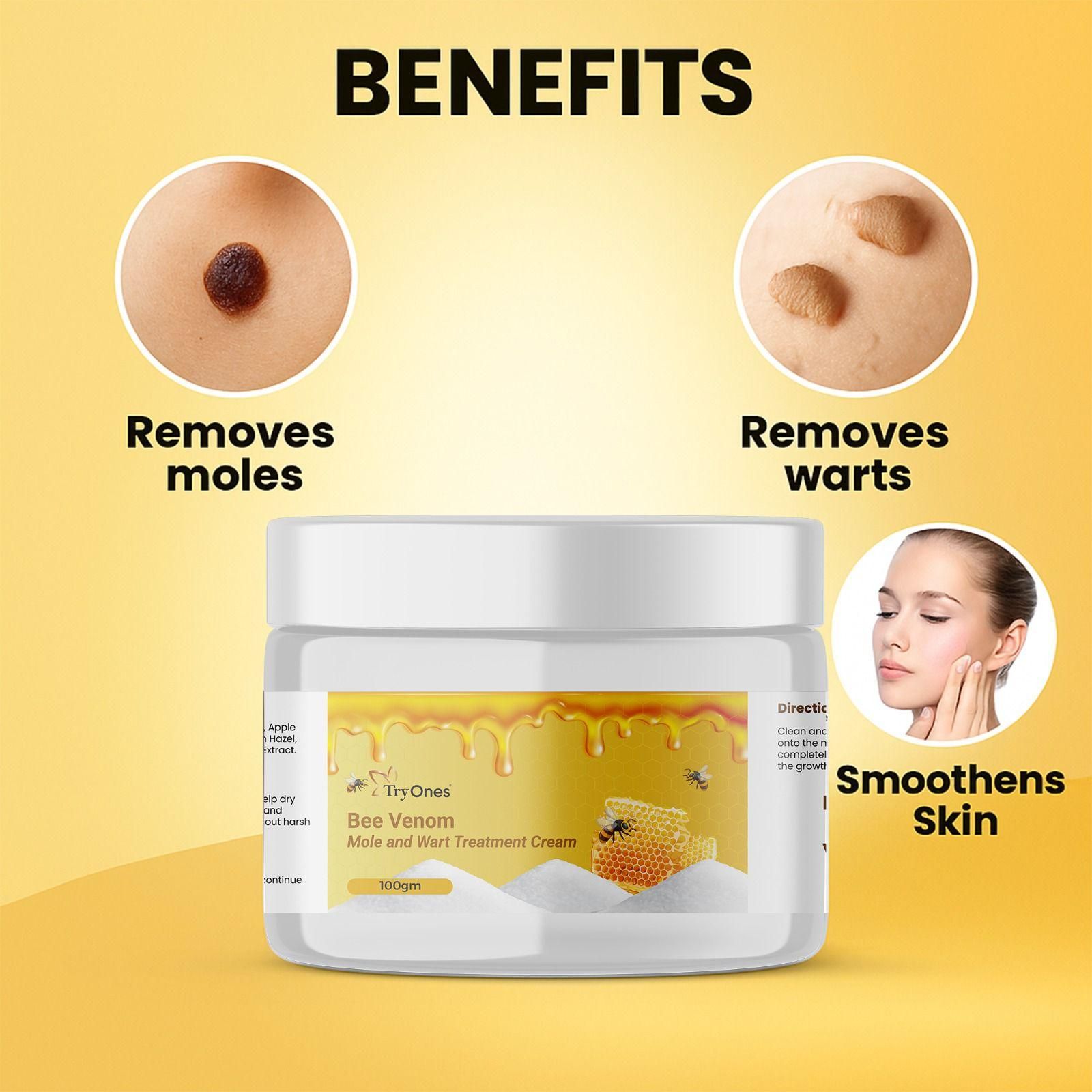 Bee Venom Mole and Wart Treatment Cream 100 gm Pack of 1