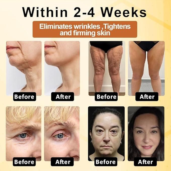 Botox Bee Advanced Multi-Action Firming Cream 100 gm Pack of 1